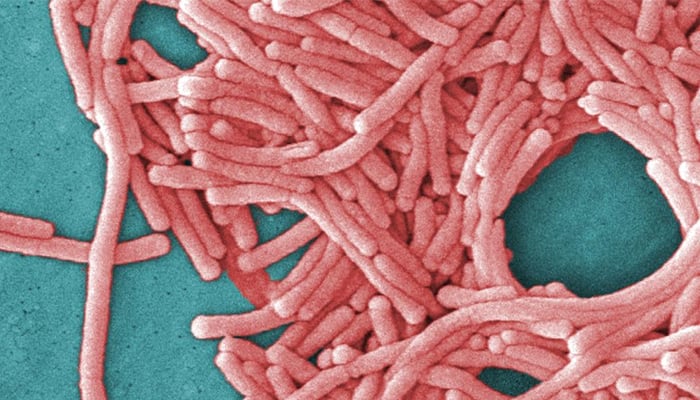 Urgent health warning issued in Potts Point, Sydney, due to legionnaires’ disease