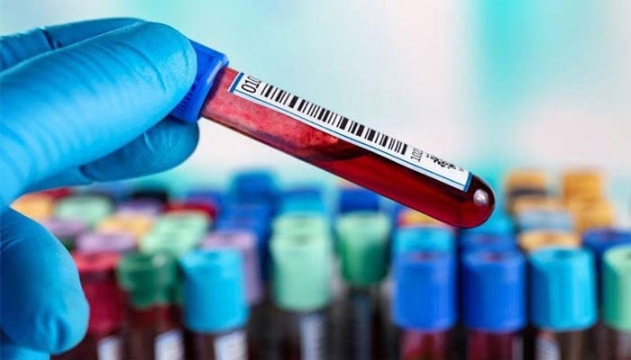 خون کا ایک عام ٹیسٹ الزائمر کی ابتدائی علامات کی نشاندہی کر سکتا ہے، تحقیق