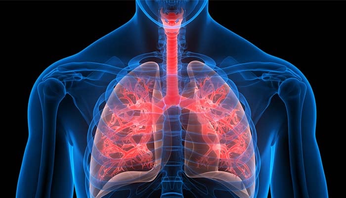What is Cystic Fibrosis? Symptoms, treatment, diagnoses