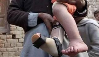 خیبرپختونخوا: ڈیڑھ سالہ بچی میں پولیو وائرس کی تصدیق