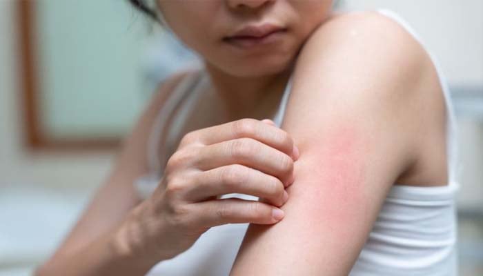 Signs your skin shows about your overall health