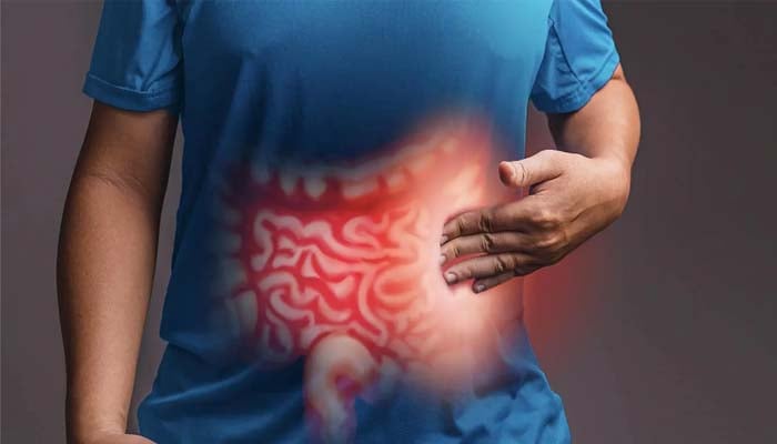 THESE common meds do not cause inflammatory bowel disease, study