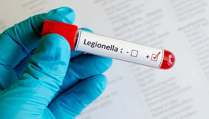 Legionnaires outbreak: 1 dead, 40 people sick in London, Ontario