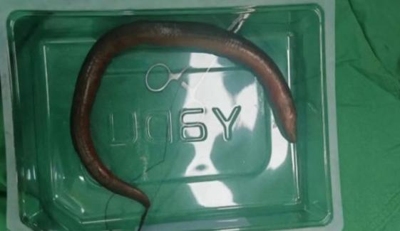 چین: ایک شخص کے پیٹ سے زندہ مچھلی نکال لی گئی، ڈاکٹرز بھی حیرت زدہ