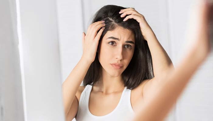Top home remedies to beat dandruff in 2025