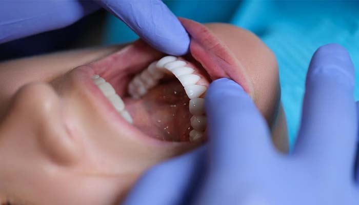 Poor oral health associated with chronic health problems, study
