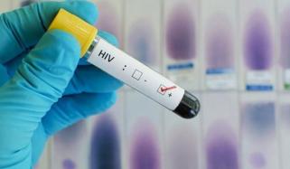 پاکستان میں HIV سے ہونیوالی اموات میں 400 فیصد اضافہ