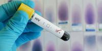 پاکستان میں HIV سے ہونیوالی اموات میں 400 فیصد اضافہ