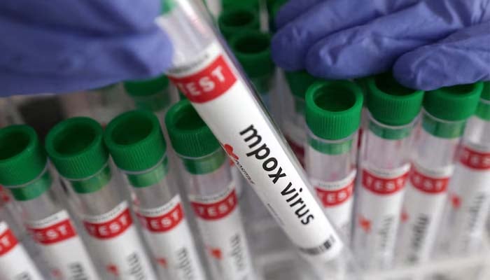 Second case of Mpox strain confirmed in Queensland