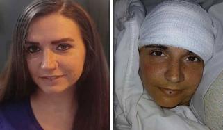 فالج زدہ خاتون کا برین چپ کے چونکا دینے والے اثرات سے متعلق انکشاف