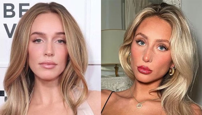 Alix Earle speaks about her relationship with Alex Cooper