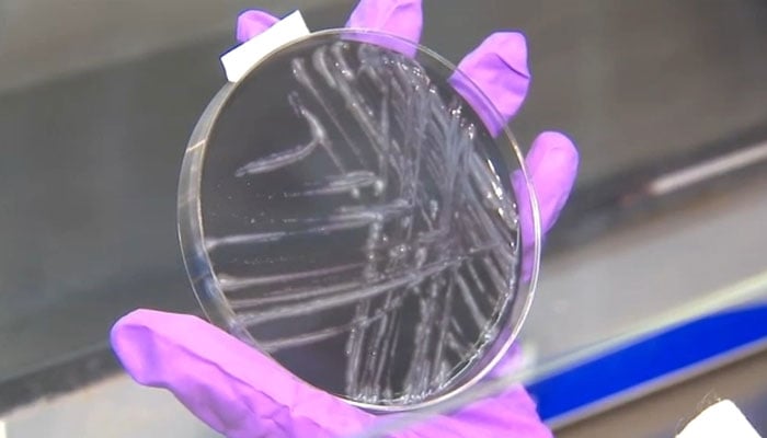 Legionnaires disease outbreak: 2 people dead among 58 affected in Harlem