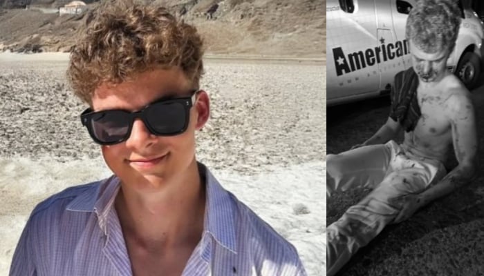 Ex-DOGE staffer big balls’ left bloodied after teen mob attack in DC