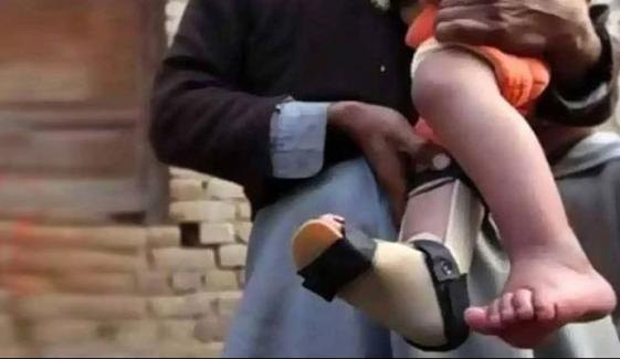 پشاور: پولیو کے نئے کیس کی تصدیق ہوگئی