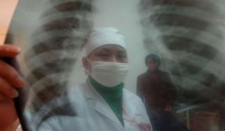 کوویڈ 19 کے مریضوں سے متعلق حیران کن تحقیق