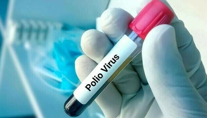 کراچی کے تمام اضلاع کے ماحولیاتی نمونوں میں پولیو وائرس کی موجودگی کا انکشاف