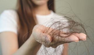 مون سون کے دنوں میں بالوں کا جھڑنا، حقیقت یا وہم؟