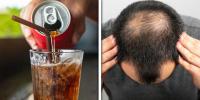 میٹھے مشروبات بال جھڑنے کا باعث بن سکتے ہیں: تحقیق میں انکشاف