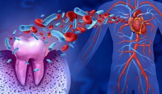 کیا منہ میں موجود جراثیم دل کا دورہ پڑنے کی وجہ بن سکتے ہیں؟