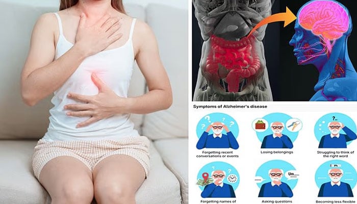 الزائمر، پارکنسن جیسے دماغی امراض کی تشخیص آنتوں سے ممکن، ماہرین