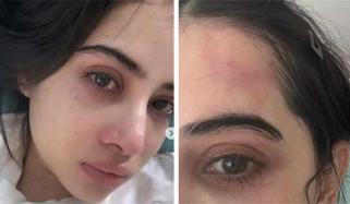 عرفی جاوید کی روتے ہوئے سیلفی نے مداحوں کو پریشان کردیا 