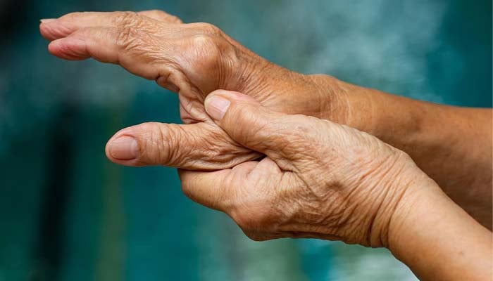 Arthritis drug Methotrexate may benefit cardiac health, study