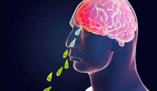 کراچی: 29 سالہ شخص نیگلیریا سے جاں بحق