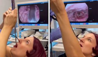 نیویارک کی خاتون نے تلوار نگل لی، ویڈیو وائرل