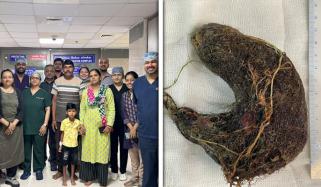 7 سالہ بچے کے معدے سے بال، گھاس اور جوتے کے تسمے کا گچھا نکال لیا گیا