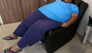 شدید موٹاپے کے شکار مریضوں کو طبی امتیاز کا سامنا