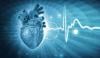 ریڈی ایشن تھراپی دل کی دھڑکن کی بیماری کے علاج میں مؤثر