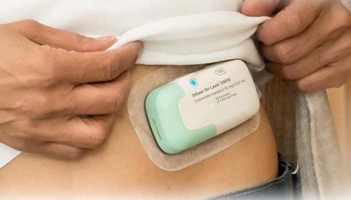 FDA grants approval to at-home variant of Lasix for cardiac failure care