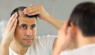 گنج پن یا بال جھڑ کا علاج ایک پودے میں پوشیدہ 