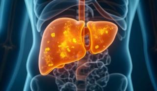 فیٹی لیور سے کیسے بچا جا سکتا ہے؟ 