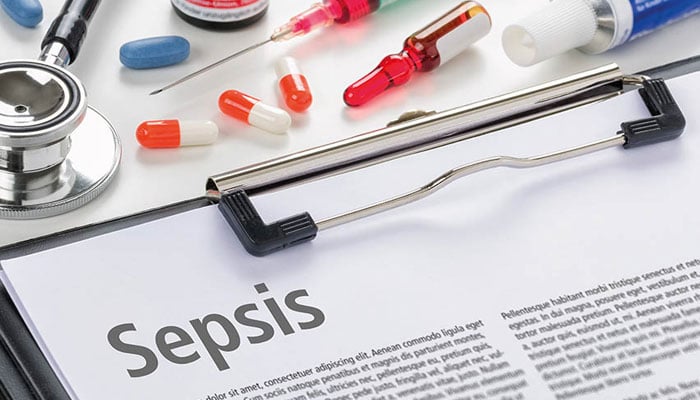 AI may assist predict sepsis risk among sick children, study