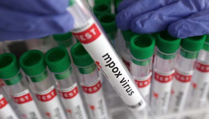 First locally acquired case of Mpox strain confirmed in California, USA