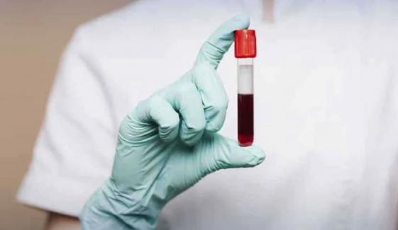 خون کے ایک ٹیسٹ سے 50 سے زائد اقسام کے سرطان کی شناخت ممکن
