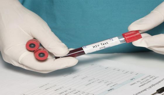 نوابشاہ: ایچ آئی وی کے 100 سے زائد کیسز رپورٹ