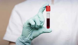 خون کے ایک ٹیسٹ سے 50 سے زائد اقسام کے سرطان کی شناخت ممکن