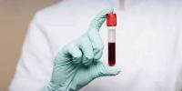 خون کے ایک ٹیسٹ سے 50 سے زائد اقسام کے سرطان کی شناخت ممکن