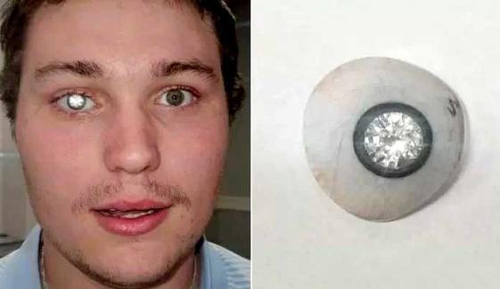 امریکی جیولر نے اپنی مصنوعی آنکھ میں قیمتی ہیرا جڑوا لیا
