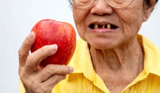 آپ کے گرتے دانت آپ کی موت کا پیش خیمہ ہوسکتے ہیں، تحقیق