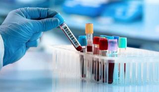 سندھ: ڈینگی اور ملیریا ٹیسٹ کی قیمتوں میں نمایاں کمی کا اعلان