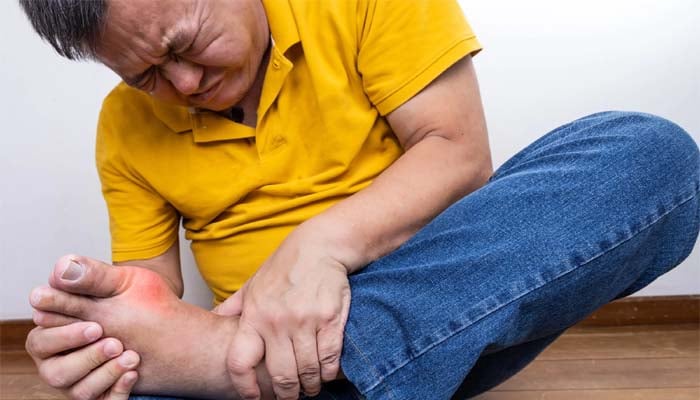 Researchers find gene ties behind fatal skin reactions to Allopurinol