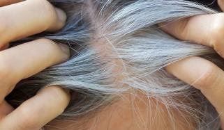 سفید بالوں اور کینسر کے درمیان غیر متوقع تعلق دریافت