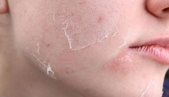 — فائل فوٹو