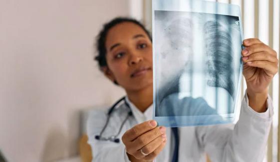 نمونیا سے بچاؤ کیلئے پانچ احتیاطی تدابیر، جنہیں اپنانا لازمی