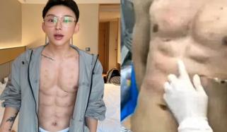 چینی انفلوئنسر نے لاکھوں ڈالر خرچ کرکے جعلی 8 پیک ایبز بنوالیے