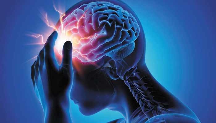دنیا بھر میں ایک تہائی افراد سر درد کا شکار ہیں، تحقیقی رپورٹ