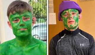 برطانوی شہری کو ہلک جیسا روپ دھارنا مہنگا پڑگیا